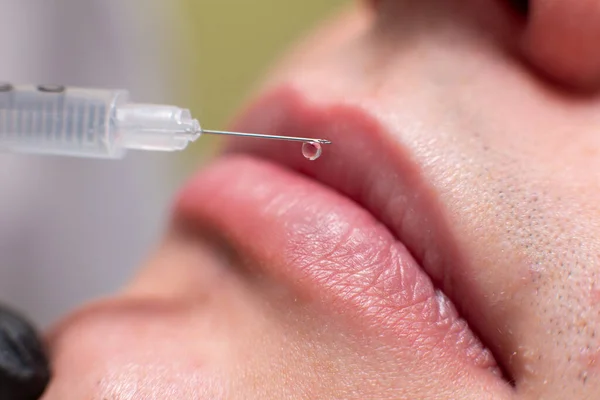 Close up of a drop of a drug falling from a syringe needle on the lips of a male patient of a cosmetology office. Rejuvenation procedure, injections of hyaluronic acid to moisturize the lips Royalty Free Stock Images