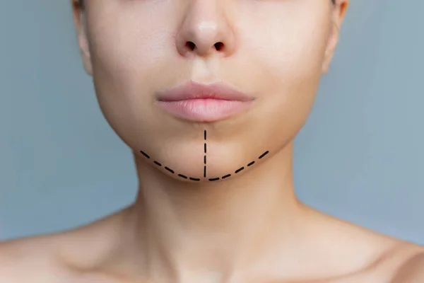 Cropped Shot Young Caucasian Woman Marking Her Chin Gray Background — Stock Photo, Image