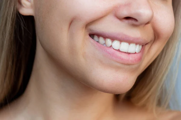 Cropped Shot Face Young Caucasian Smiling Blonde Woman Dimples Her — Stock Photo, Image