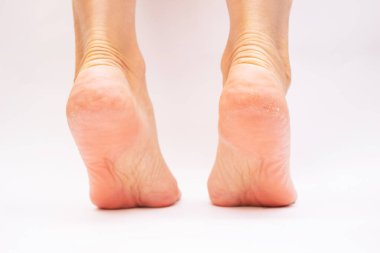 cropped image of female barefoot feet on white background