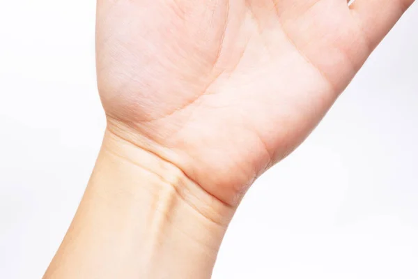 Cropped Image Female Hand Peeling Skin — Stock Photo, Image