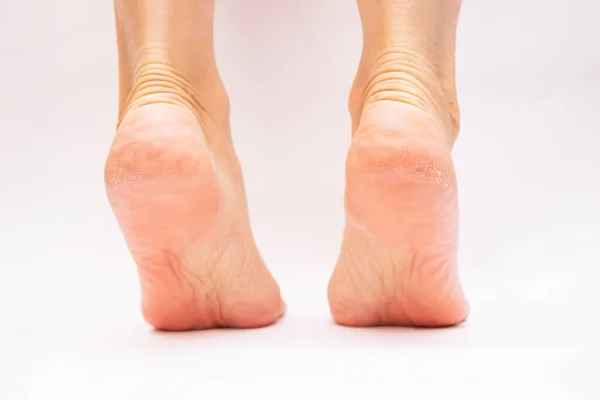 Cropped Image Female Barefoot Feet White Background — Stockfoto