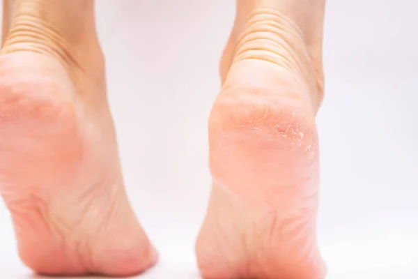 Cropped Image Female Barefoot Feet White Background — Stockfoto