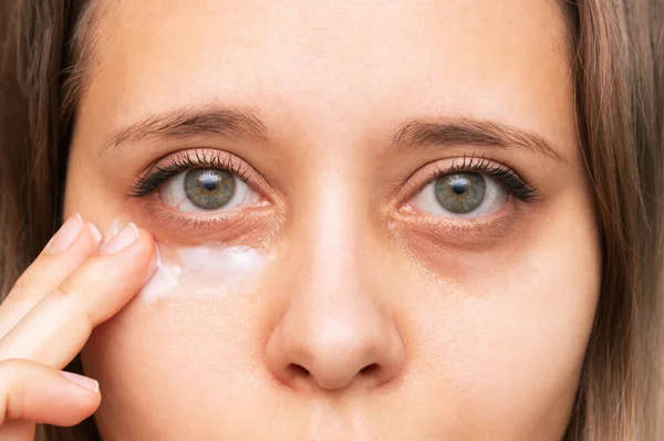 Close Young Woman Applying Cream — Stock Photo, Image