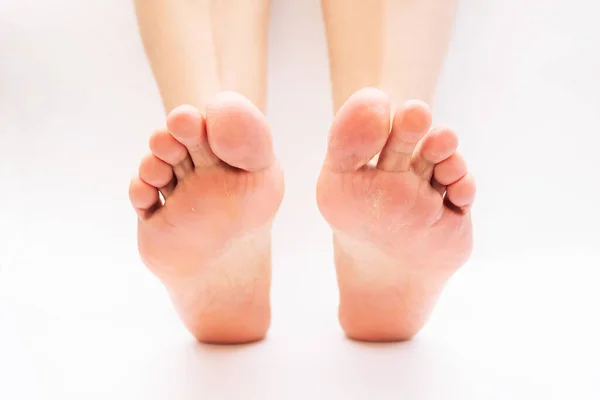 Cropped Image Female Barefoot Feet White Background — Stockfoto