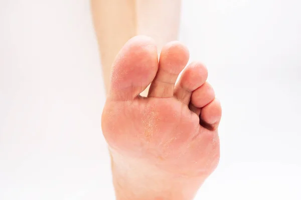 Cropped Image Female Barefoot Feet White Background — Stockfoto