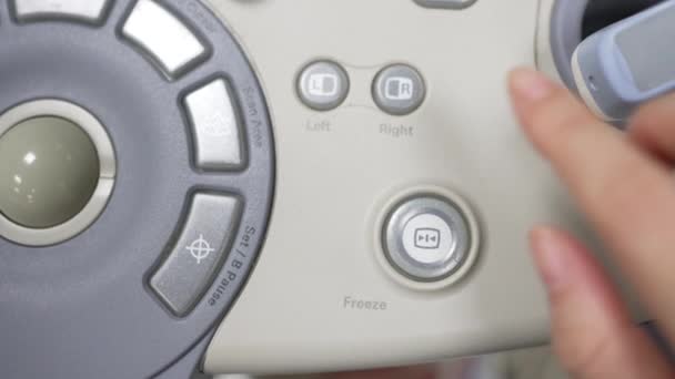 超声波机冻结按钮上按压声纳机的闭手 — 图库视频影像