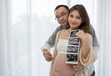 Asyalı hamile çift pencerenin yanında sarılıyor ve dikiliyor. Eş, Bebeğin Ultrasonografisini Tutuyor