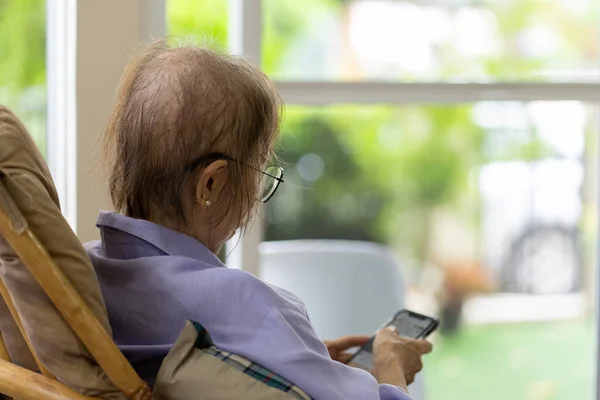 Senior Woman Hair Loss Chemotherapy Breast Cancer Using Smartphone Home — Fotografia de Stock