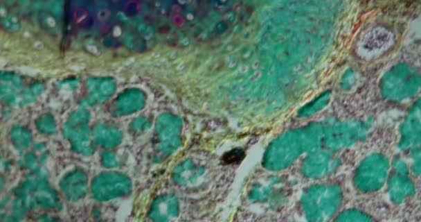 Asma Pulmonar Bajo Microscopio 100X — Vídeo de stock