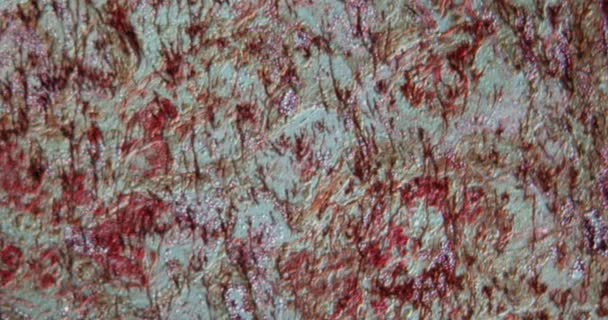 100X显微镜下肺中的Aids念珠菌 — 图库视频影像