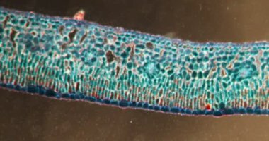 Azalea, rhododendron mikroskop altında Darkfield dokusundan ayrılır.