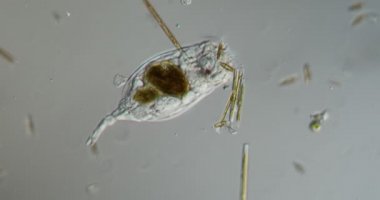 Rotifer derede 100 kat daha fazla yiyecek arıyor.