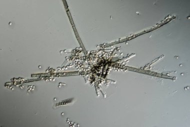 Mikroskop altında Aspergillus küf lifleri ve sporları.