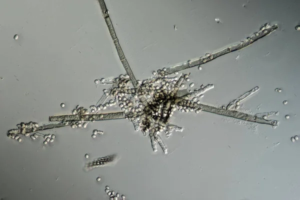 Filamentos Molde Esporos Molde Aspergillus Sob Microscópio — Fotografia de Stock