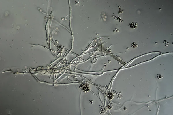 Filamentos Moho Esporas Del Molde Aspergillus Bajo Microscopio — Foto de Stock