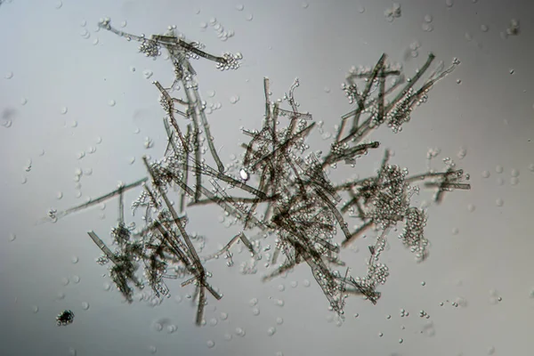 Filamentos Moho Esporas Del Molde Aspergillus Bajo Microscopio — Foto de Stock