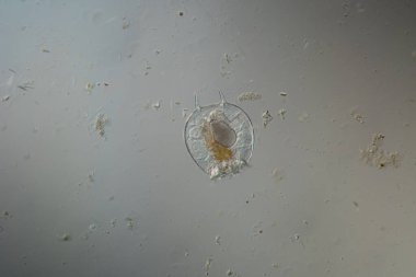 Rotifer derede 100 kat daha fazla yiyecek arıyor.