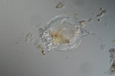 Rotifer derede 100 kat daha fazla yiyecek arıyor.