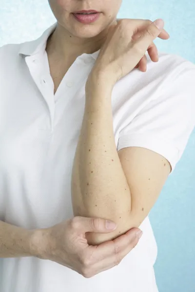 Dolor de codo en una mujer — Foto de Stock