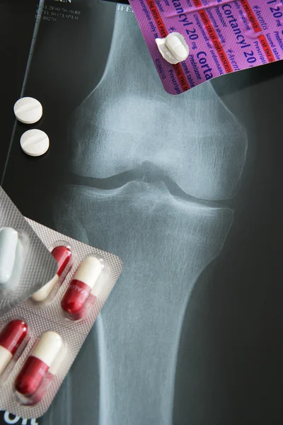 MEDICATION FOR PAIN — Stock Photo, Image