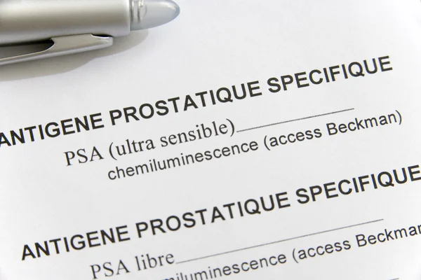 Screening rakoviny prostaty — Stock fotografie