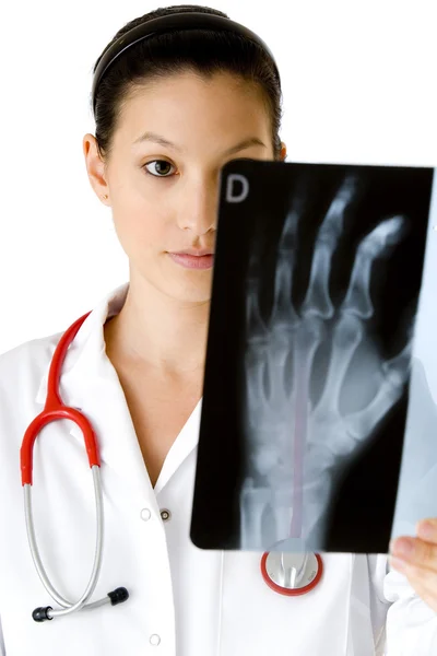 Hand, X-ray — Stockfoto