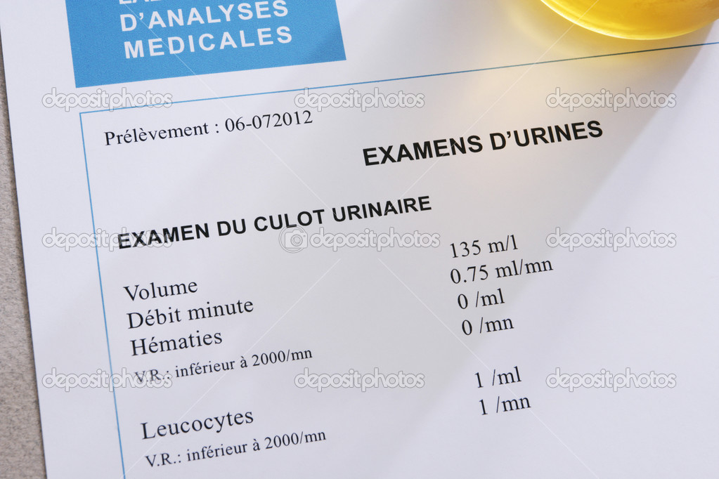 analyse urine analyse urine