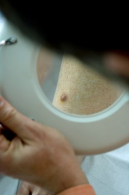 Dermatoloji, belirtiler elde