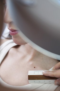 Dermatoloji, belirtiler, kadın