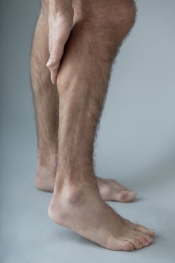 bir erkeğin bacak ağrısı