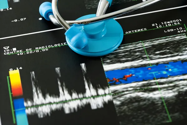 DOPPLER TEST OF AN ARTERY — Stock Photo, Image