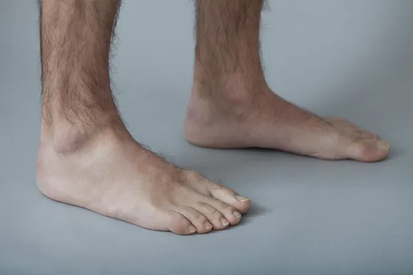 Dolor en los pies, hombre — Foto de Stock