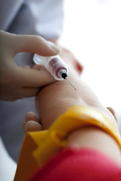 ESPECIÁRIOS DE SANGUE EM UMA MULHER — Fotografia de Stock