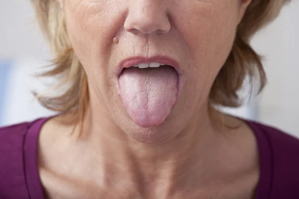 TONGUE — Stock Photo, Image