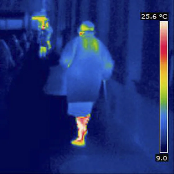 THERMOGRAM — Stock Photo, Image