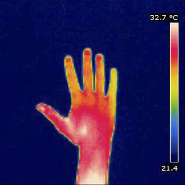 THERMOGRAM — Stock Photo, Image