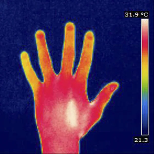 THERMOGRAM — Stock Photo, Image