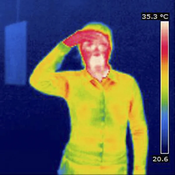 THERMOGRAM — Stock Photo, Image