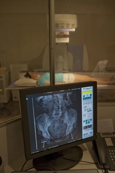 Bekken, x-ray onderzoek — Stockfoto