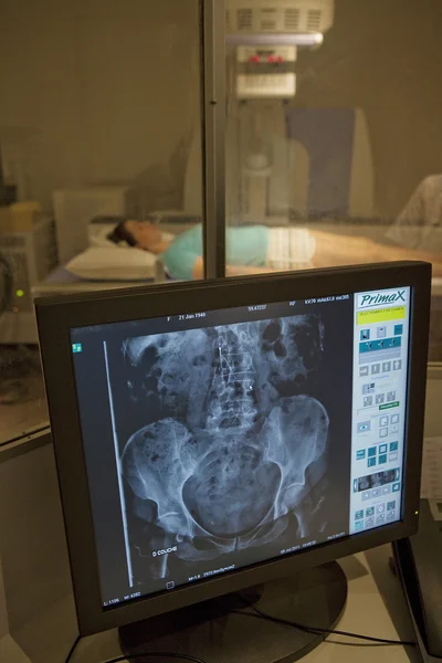 Bäckenet, röntgenundersökning — Stockfoto