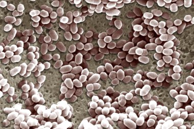 Listeria ivanovii