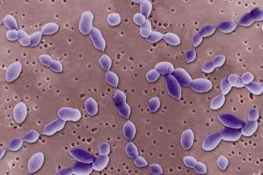 anaerobe elektron mikroskobu altında