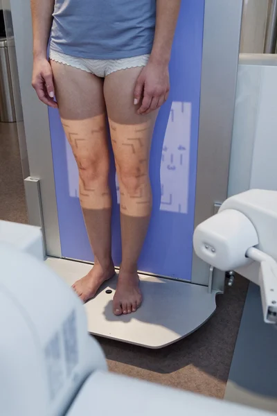 KNEE, X-RAY EXAMINATION — Stock Photo, Image