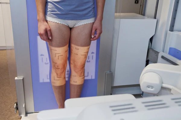 Knie, x-ray onderzoek — Stockfoto
