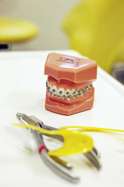교정 치과 재료 — 스톡 사진