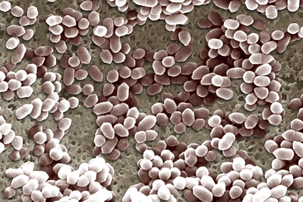 Listeria ivanovii