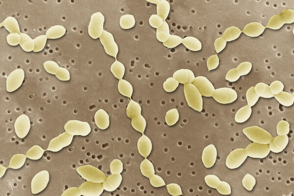 Аэроб под электронным микроскопом
