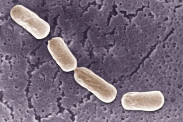 在电子显微镜下的厌氧菌 — 图库照片