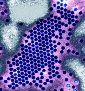 poliovirus imajını olumsuz leke